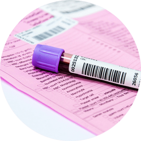 Download Blood Sample Or Urine Sample Blood In Edta Tube Png Image With No Background Pngkey Com