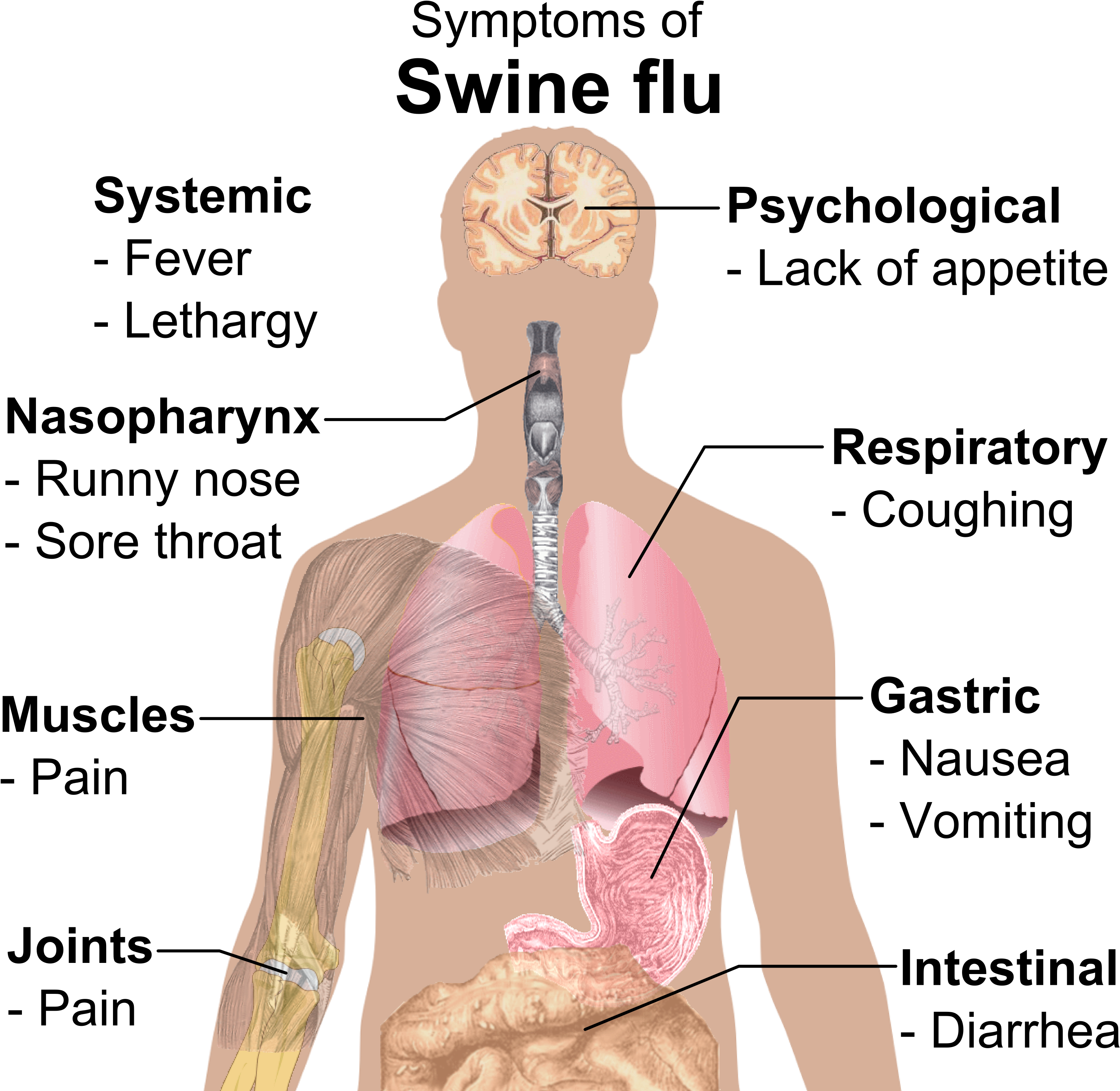 Symptoms Of Swine Flu - Swine Flu Symptoms (3171x3057), Png Download