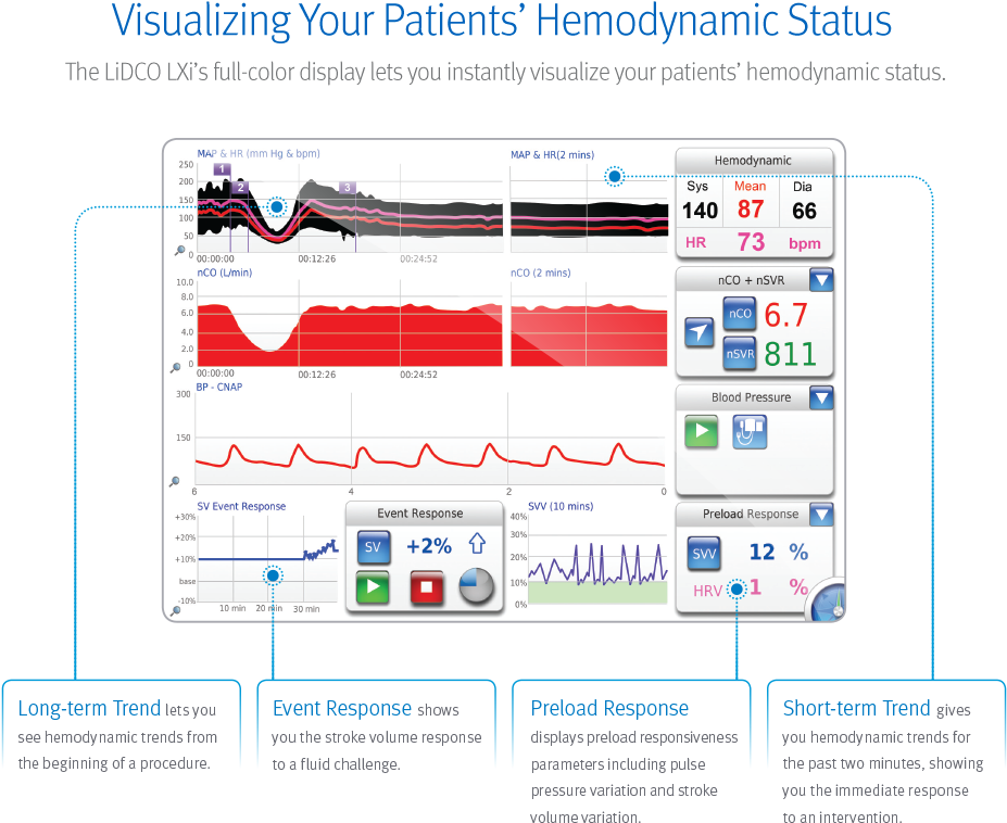 Hemodynamics (960x792), Png Download