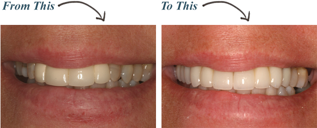 Full-mouth - Full Mouth (752x369), Png Download