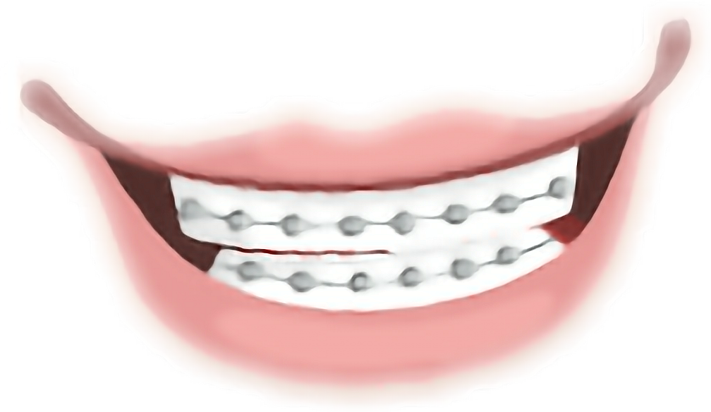 Report Abuse - Tongue (1008x584), Png Download