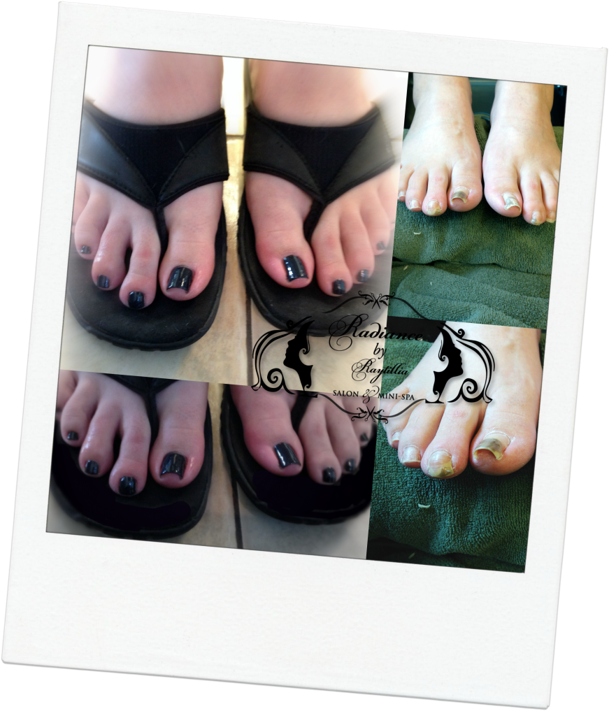 Http - //www - Radiancebyraytillia - Com/wp - Toe (877x1024), Png Download