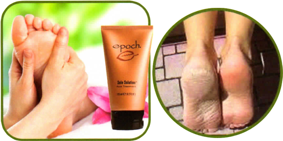 Natural Ice Dancer Pedicure - Nu Skin Sole Solutions Foot Treatment (583x292), Png Download