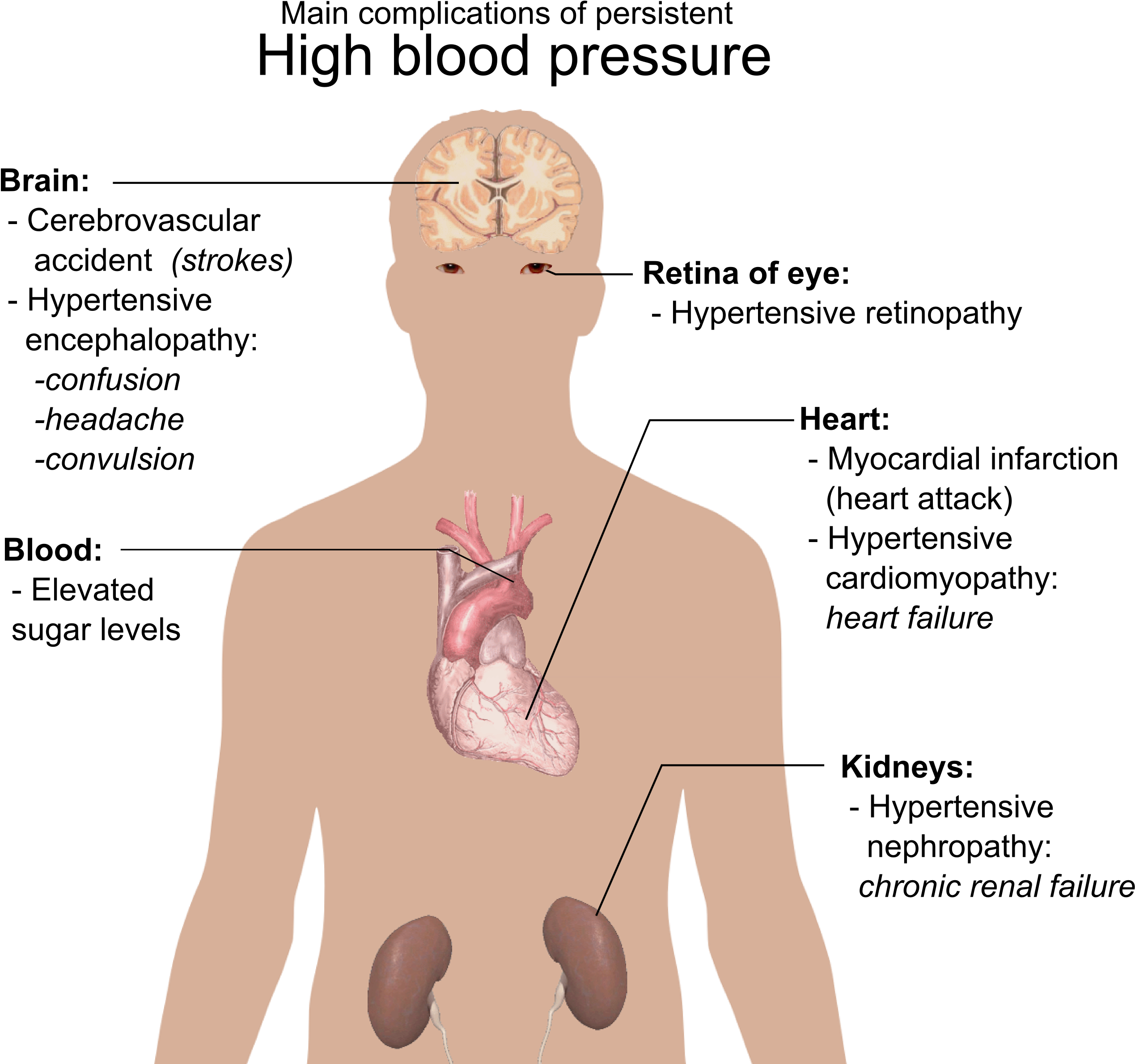 Main Complications Of Persistent High Blood Pressure - Do You Know If You Have High Blood Pressure (2587x2391), Png Download
