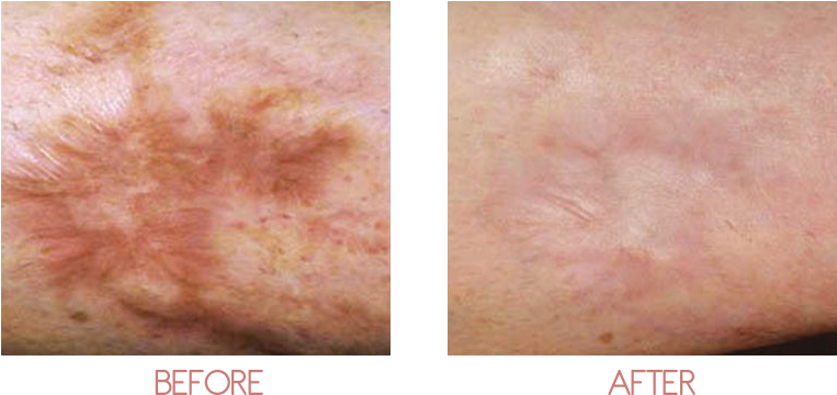 Feel Confident With Your Skin - Scar (800x400), Png Download