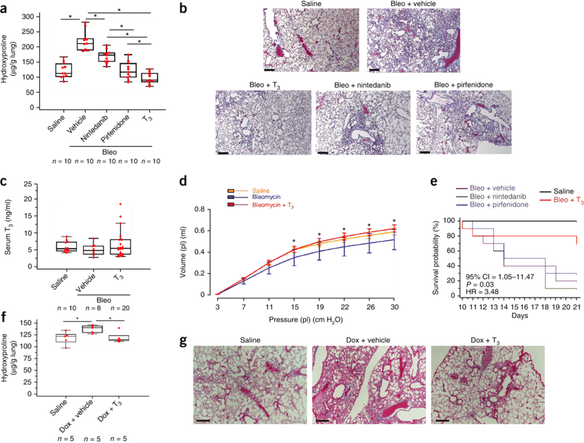 Aerosolized T 3 Blunts Established Fibrosis In Two - Pulmonary Fibrosis (850x646), Png Download