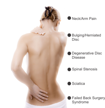 Woman Back Pain Symptoms - Back Pain Female Png (400x409), Png Download