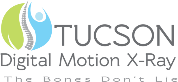 Seeing Instability - Tucson Digital Motion Xray (1200x600), Png Download