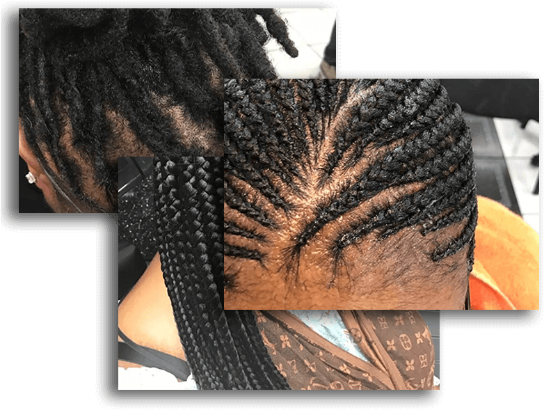 Dreadlocks And Retwist, Micro Braids, Pick And Drop, - Lace Wig (800x617), Png Download