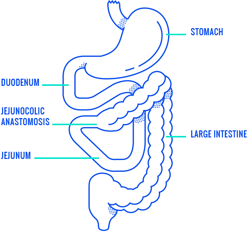 Jejunocolic Anastomosis And The Digestive System - Human Digestive System (484x454), Png Download