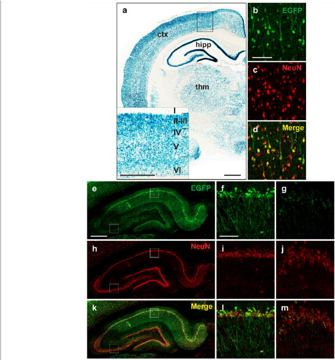 Raprnp Vector Drives Expression In Rat Neurons - Visual Arts (850x733), Png Download