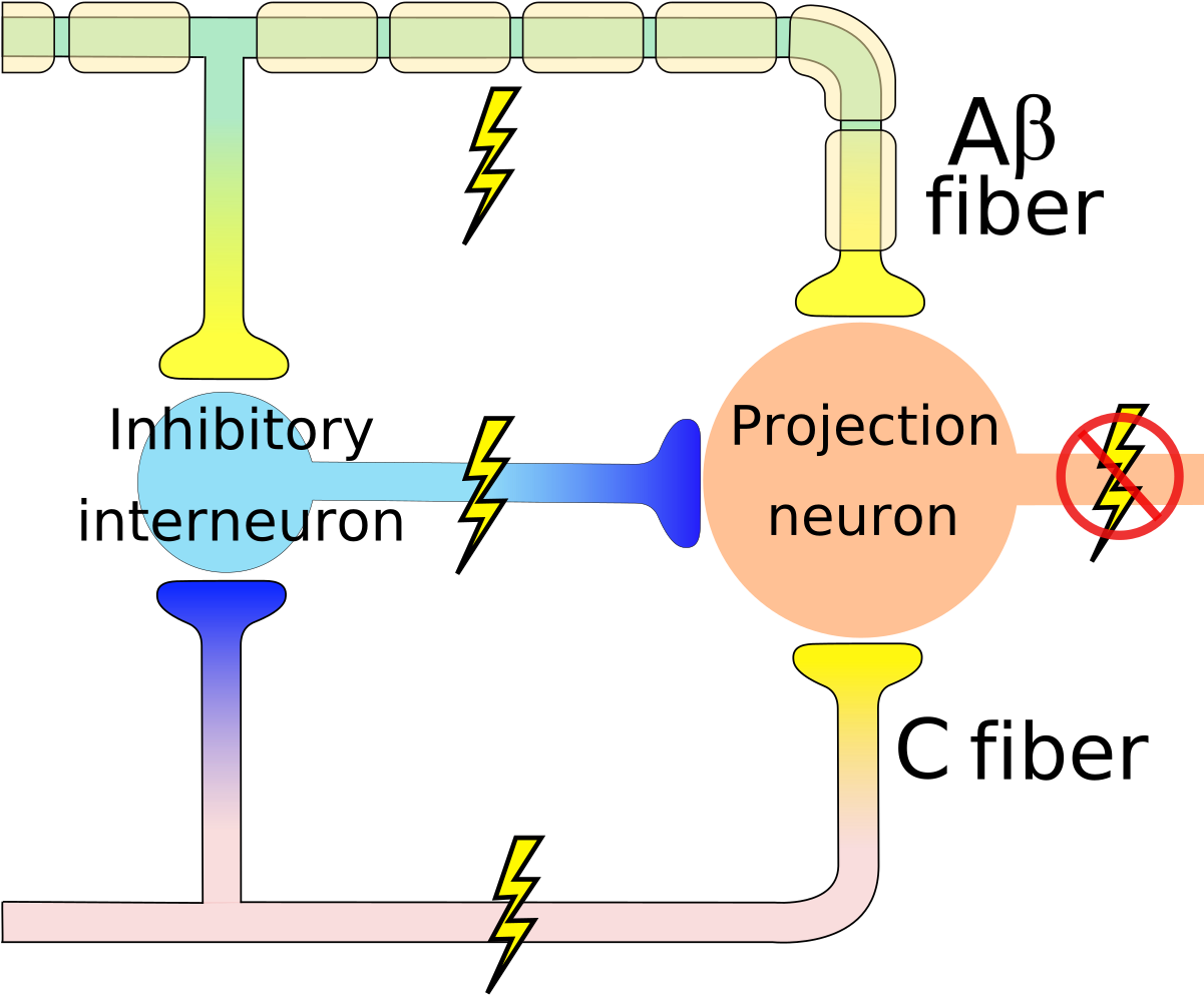 Gate Control Theory (1200x999), Png Download