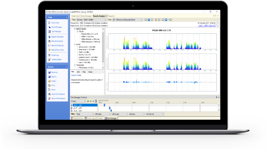 Most Versatile Voice Quality Test Solution - Google Analytics 360 Salesforce (1000x600), Png Download