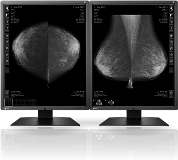 1cm Monochrome Lcd Monitor - Radiforce Gx550-p-bk - 21.3" Ips Led Monitor - 4:5 (400x410), Png Download