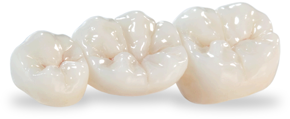 Bruxzir® Solid Zirconia Crowns And Bridges - Zirconia Crowns And Bridges (594x400), Png Download
