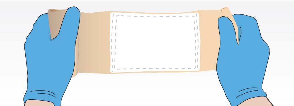 If You See The White Pad When You Open The Dressing, - Pressure Dressing (1020x368), Png Download