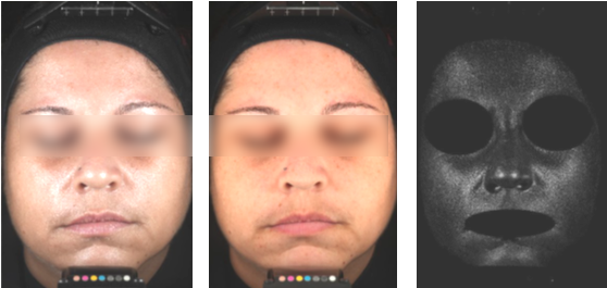 Equipamentos & Avaliações - Scar (570x279), Png Download