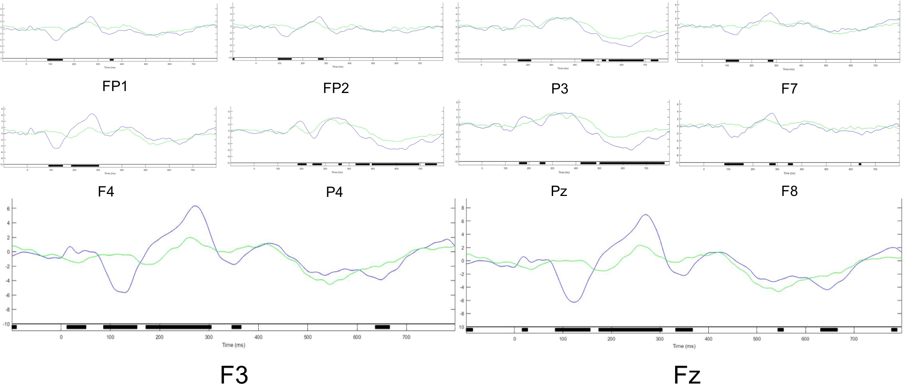 Results Of Erps On 10 Channels With A Significant Difference - Diagram (1835x816), Png Download