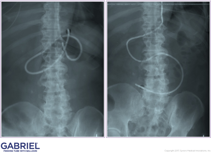 Gftb Casestudies Email 021517-1 - Medical Imaging (784x606), Png Download