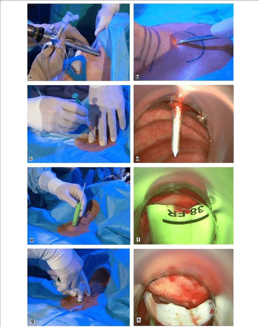Handling The Ted - Collage (850x1073), Png Download