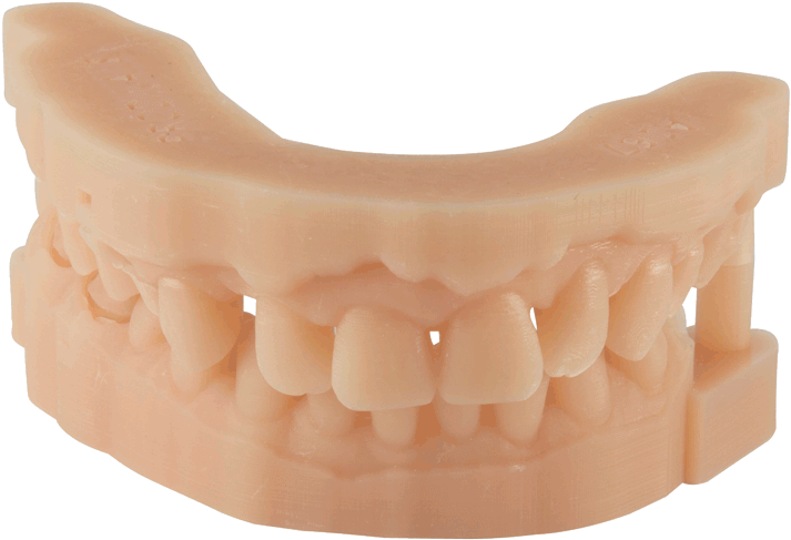Dental Material 3d Printing For Dental Parts - 3d Printed Dental Model (800x600), Png Download
