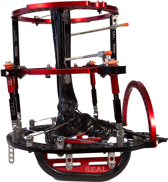 5 - Bicycle Pedal (600x853), Png Download