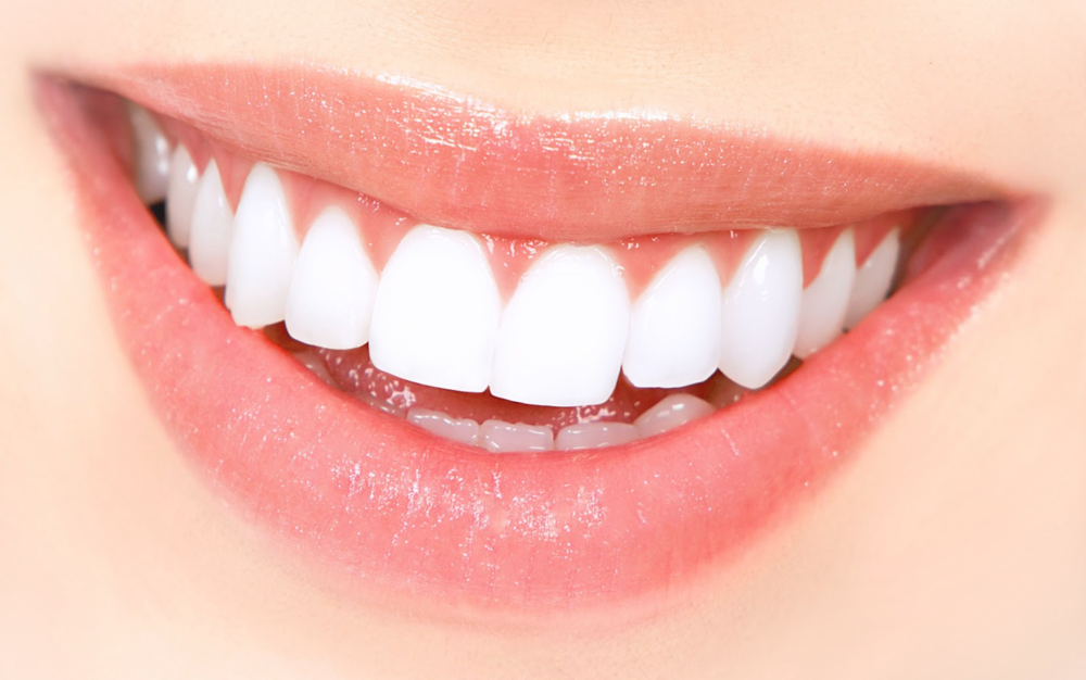 Perfect Smile2 (1000x626), Png Download