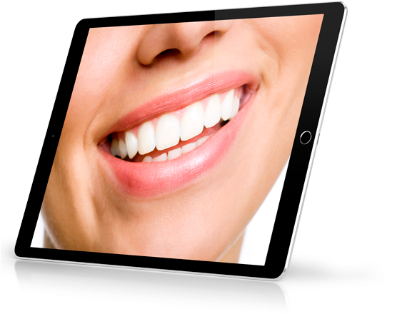 Dentatis Ipad Sonrisa - Everwhitetm Teeth Whitening Accelerator Light 5x More (600x451), Png Download