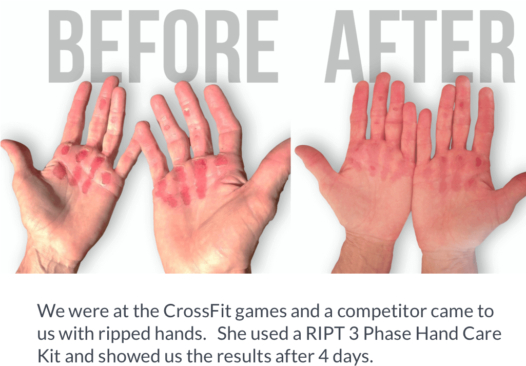 By The Time The Skin Rips Off, It Will Be A Lot Dryer - Jergens Wet Skin Natural Glow (1024x900), Png Download