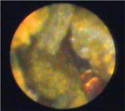 Spyglass™ Direct Visualization System - Earth (600x600), Png Download