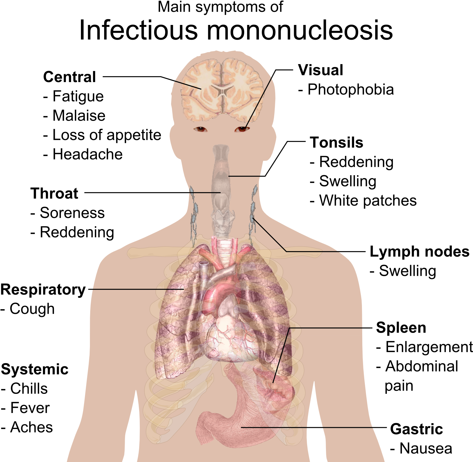 Main Symptoms Of Infectious Mononucleosis - Epstein Barr Virus (1693x1613), Png Download