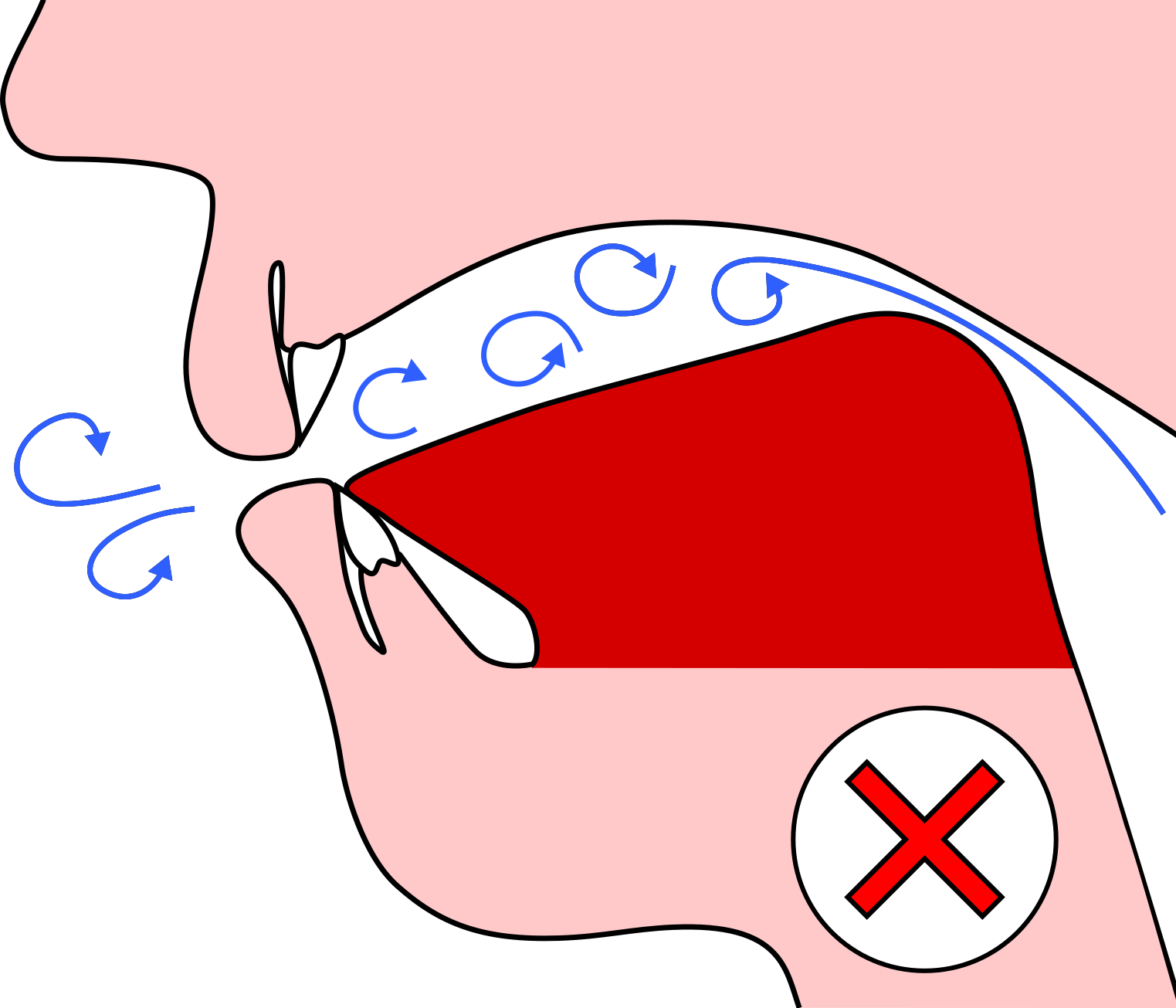 Rear Of Tongue Raised (1523x1305), Png Download