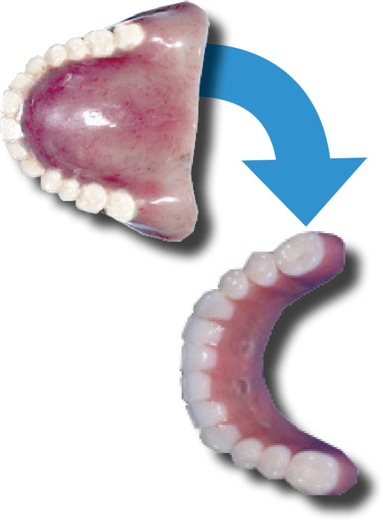 Implants There Is No Need For Thick, Long Flanges On - Insect (794x1064), Png Download