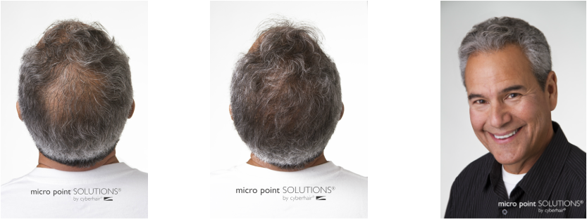 Micropointlinks - Biotopic - Premium Hair Growth Shampoo With Biotin (833x312), Png Download