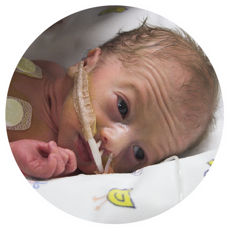 Every Human Touch Caused Her Blood Pressure To Drop - Baby (768x781), Png Download