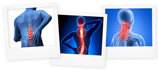 Polaroid Images Of A Persons Back With Key Areas Clearly - Salcoll Collagen Marine Collagen - Salmon Collagen (674x300), Png Download