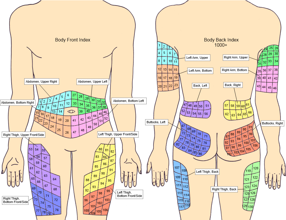 Injection Sites Index - Printable Insulin Injection Site Rotation Chart (1000x763), Png Download