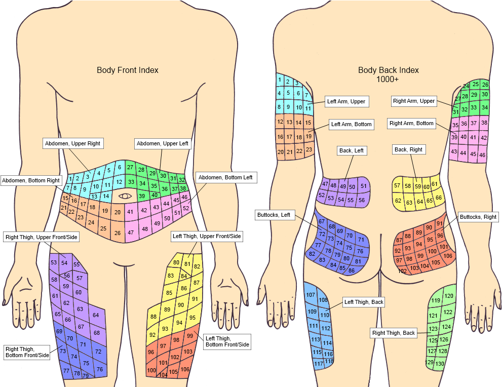 Insulin Injection Rotation Sites Chart