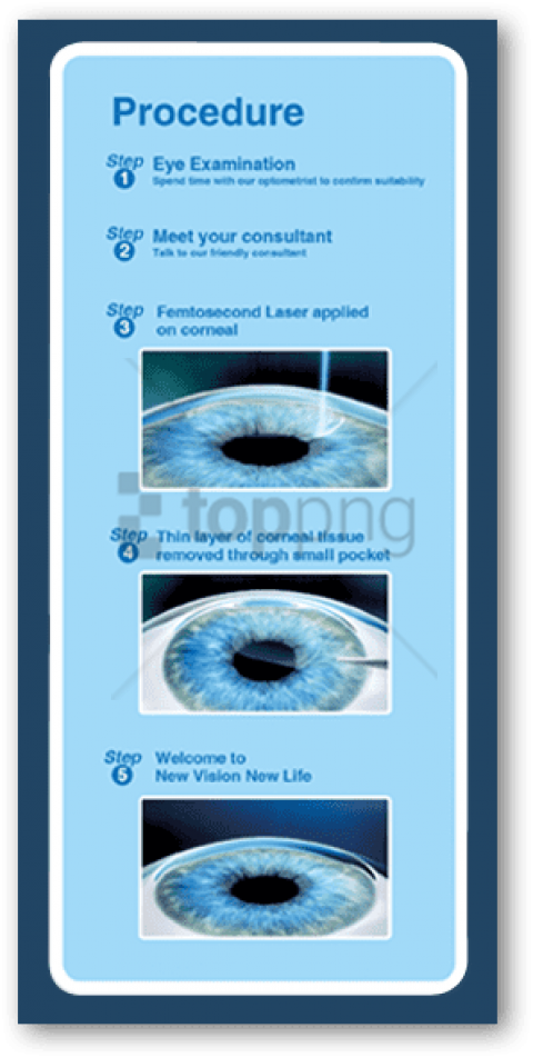 Relex Smile Is A Less Invasive Way To Treat Short-sightedness - Circle (298x591), Png Download