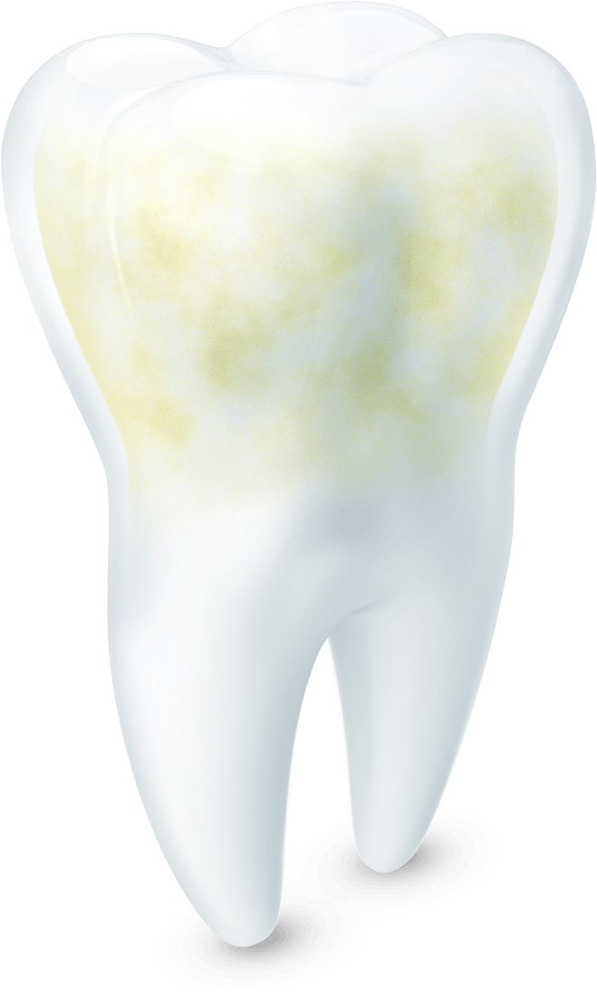 Une Dent Blanche Et Saine À Côté D'une Dent Jaunie - Acid (659x1096), Png Download