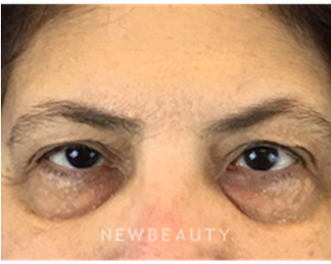 Dr Dav - Close-up (367x441), Png Download