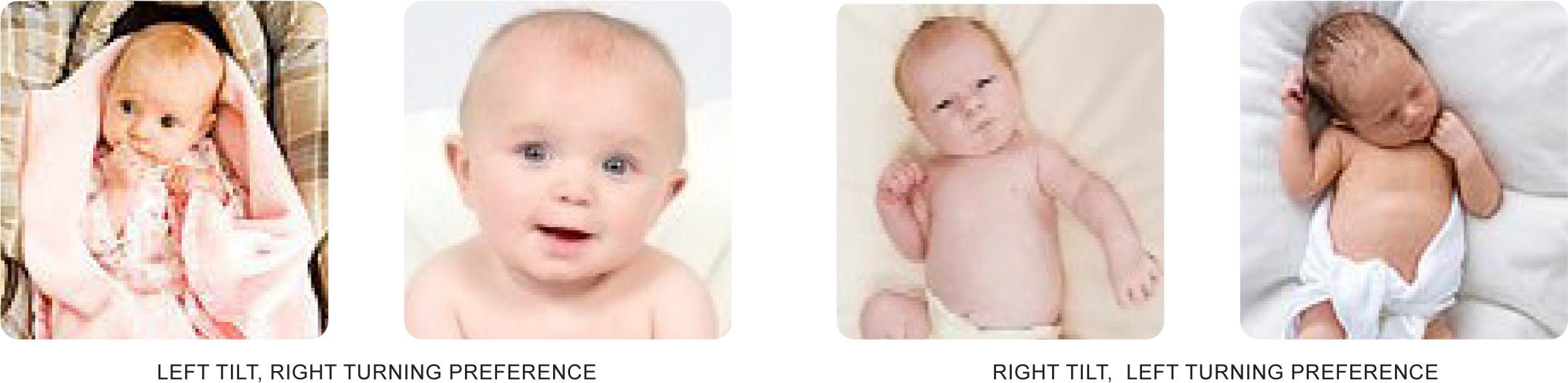 Headposturepreferences3 - “ - Torticollis Posture (2514x630), Png Download