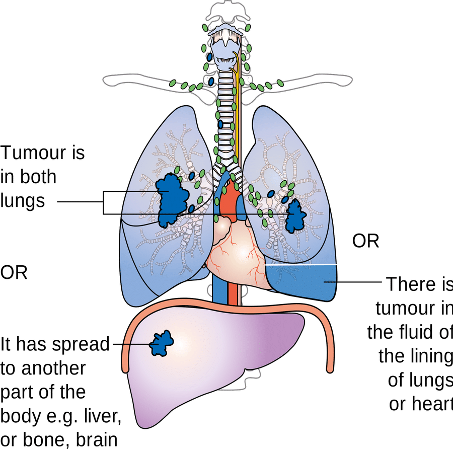 Negative Effects Of Smoking - Does Asbestos Affect The Lungs (900x900), Png Download
