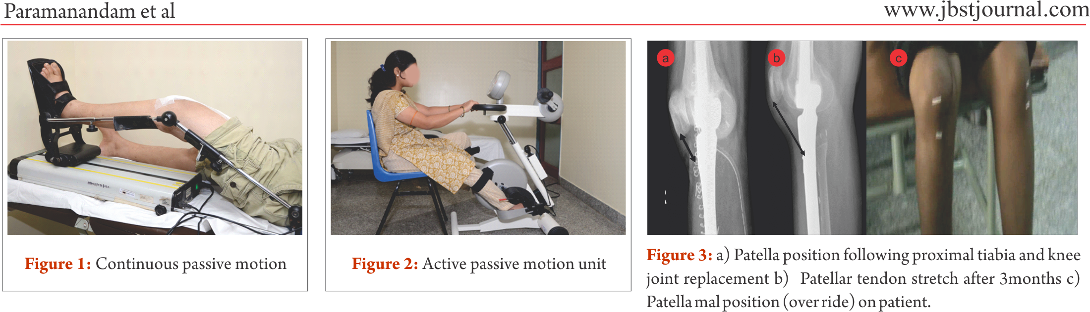 Largely Depends On The Bone And Joint Structure Loss - Computed Tomography (2198x643), Png Download