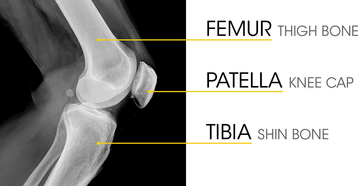 Knee Anatomy - Bone Knee (1247x648), Png Download