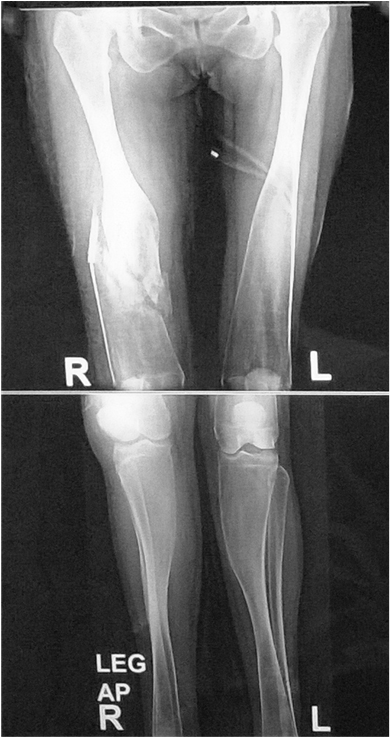 36 Years Old Female Patient Radiography Of Both Knee - X-ray (902x736), Png Download