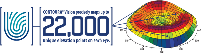 As Part Of Your Complimentary Lasik Consultation At - Diagram (703x191), Png Download