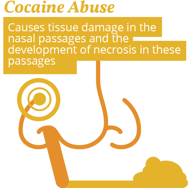 Cocaine And Nose Issues - Nasal Passage Of Cocaine Addict (675x675), Png Download