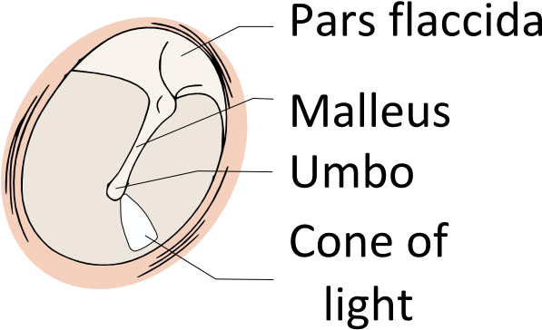Tympanic Membrane Pars Flaccida (701x400), Png Download