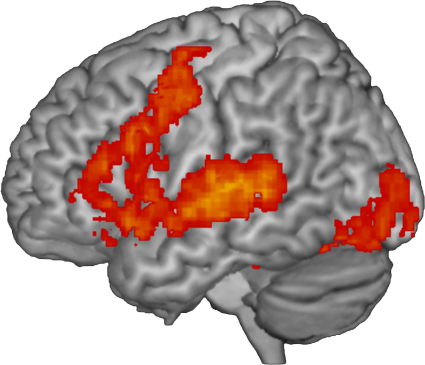Your Brain On Words - Functional Magnetic Resonance Imaging (899x779), Png Download